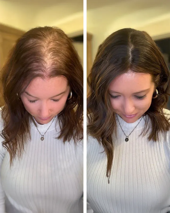 Comparação de Juliana, 42
